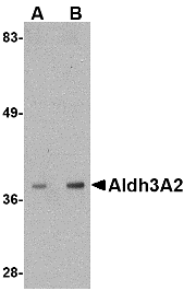 Antibody product image